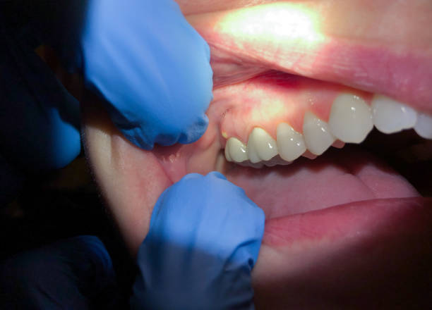 Best Broken Tooth Emergency  in Boonville, IN